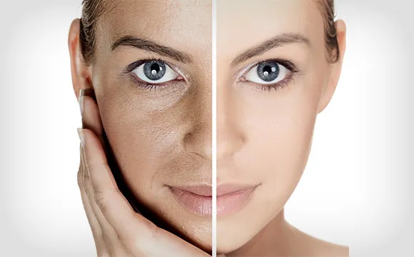 Facial rejuvenation at the practice